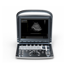 Portable 4D/3D therapeutic Doppler gynecological heart scanning ultrasound machine with printer